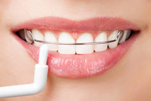 TEETH CLEANING