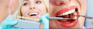 riggsbanner-whitening