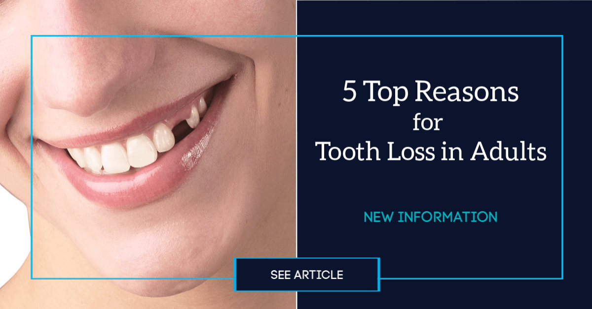 Tooth Loss